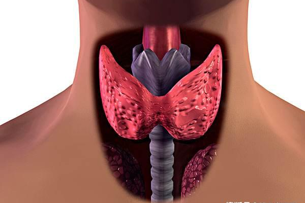 什么是CDN甲状腺？它与甲状腺疾病有何关联？