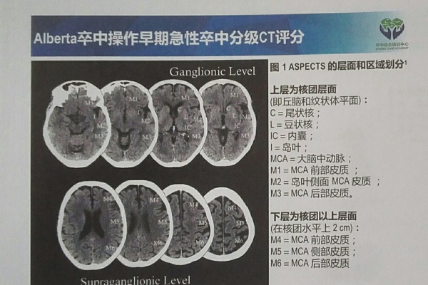 aspects 使用 _如何选择组件版本  第1张