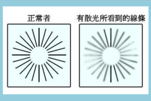 高散光定制是因为店里没片吗-为什么要定制,高散光镜片为什么要定制