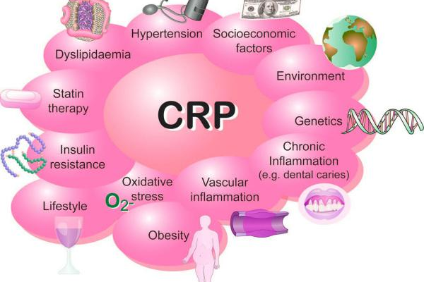 什么是CRP检查？它有何医学意义？  第1张