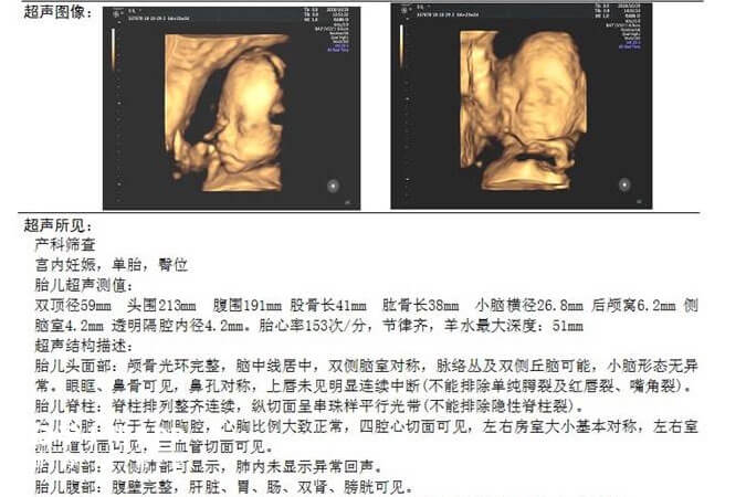 彩超数据分析_数据分析  第1张