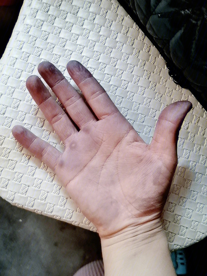 染发剂弄到手上怎么搞  第1张