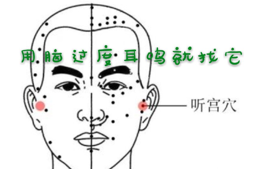 为什么qq多了一个耳朵  第1张