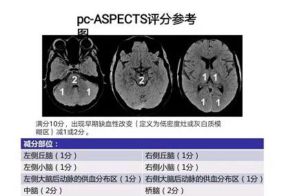关于aspects的使用方法,有哪些核心技巧与常见问题? 第2张 关于aspects的使用方法,有哪些核心技巧与常见问题? 第2张