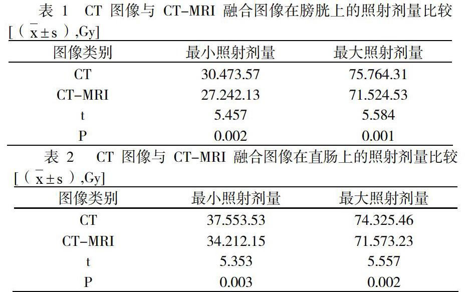 何谓放射性图像融合技术,放射性图像融合技术有哪些应用 第1张 何谓放射性图像融合技术,放射性图像融合技术有哪些应用 第1张