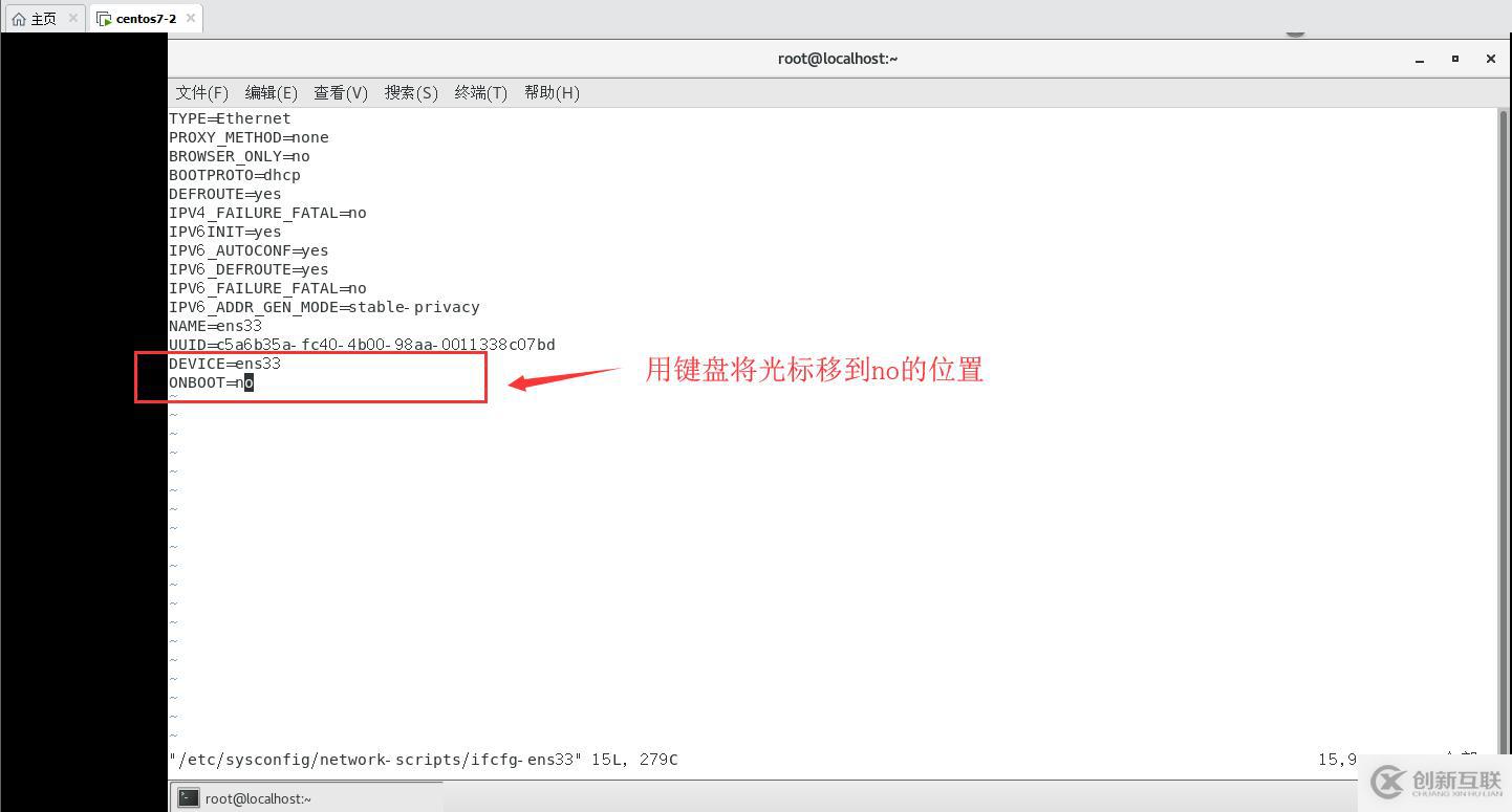 linux 如何远程管理