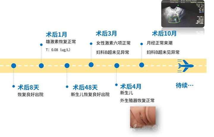 附件有效期一般是多少天?,附件有效期过期后如何恢复? 第1张 附件有效期一般是多少天?,附件有效期过期后如何恢复? 第1张