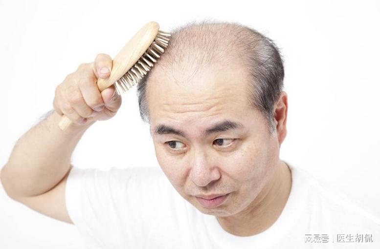 秃的配置是什么?,秃头配置怎么选择适合自己的 第3张 秃的配置是什么?,秃头配置怎么选择适合自己的 第3张