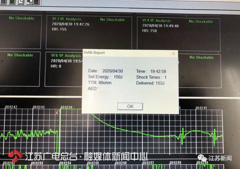 服务器客户端心跳保持是什么,心跳间隔多少秒最佳